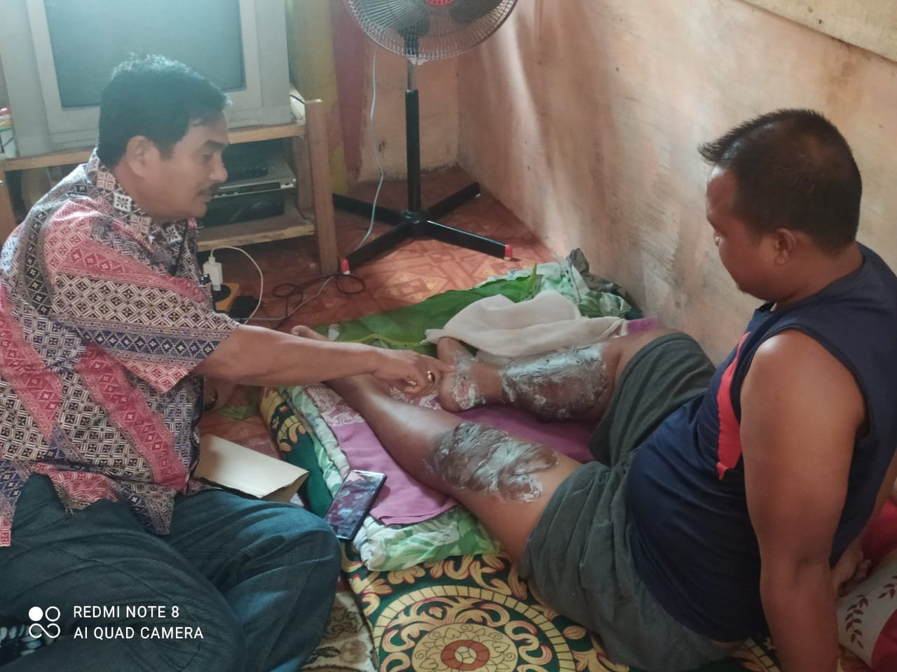 legislator DPR Aceh Asib Amin,Kunjungi Korban Kecelakaan Kerja